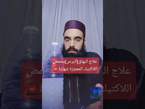 علاج البهاق بحمض اللاكتيك المعجزة شهادات كثيرة حمض اللاكتيك البهاق