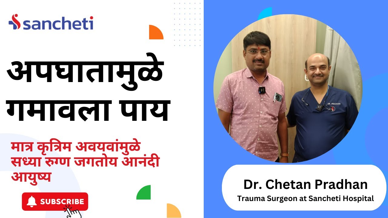 अपघातामुळे गमावला पाय। मात्र कृत्रिम अवयवांमुळे सध्या रुग्ण जगतोय आनंदी आयुष्य । Dr. Chetan Pradhan