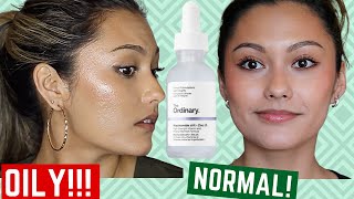 The Ordinary Niacinamide REVIEW | How to Control Oily Skin