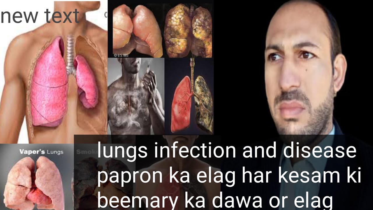 asthma injection_asthma treatment,asthma medicine, asthma tablet,asthma ...