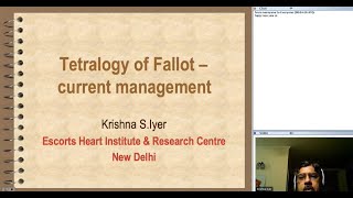 Current Trends In Management Of Tetralogy Of Fallot Dr Ks Iyer