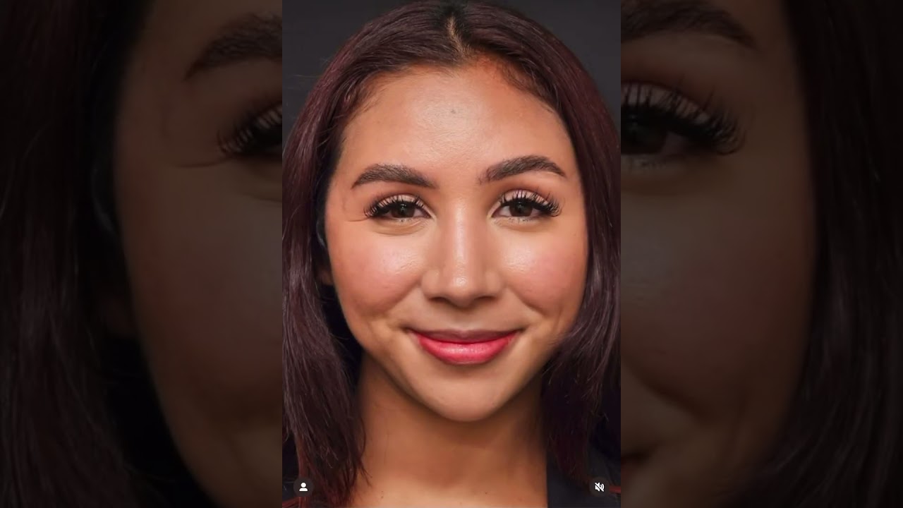 Rhinoplasty patient of Dr. Shervin Naderi, before and after video