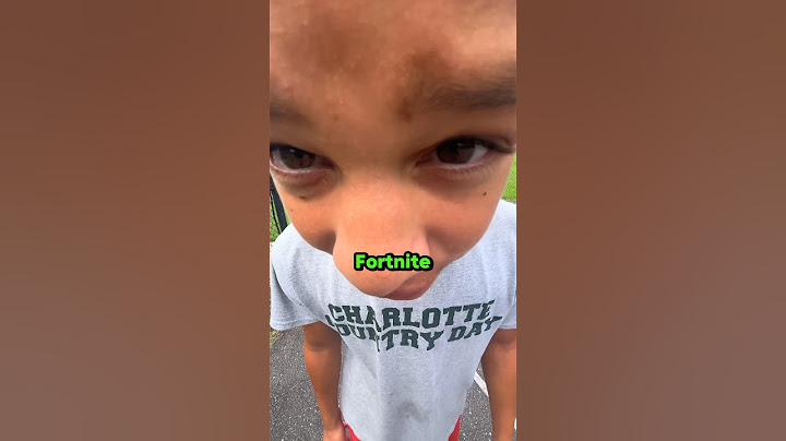 This Kid Really Needs to Touch Grass 😂 #shorts #basketball #viralvideo