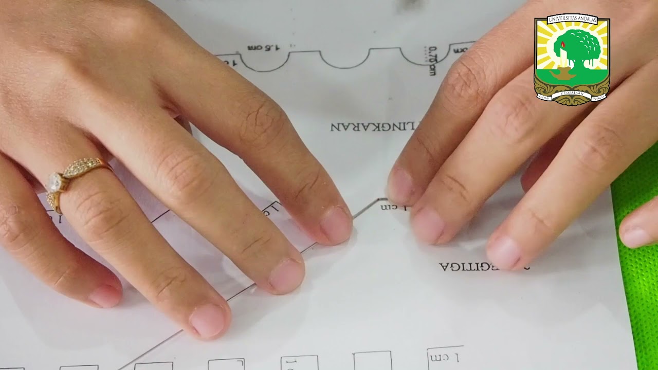 Blok 1 FKG UNAND: manipulasi kawat ortodonti segitiga