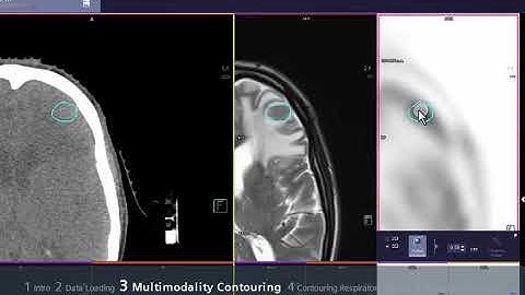 syngo via VB10 MM RT Image Suite