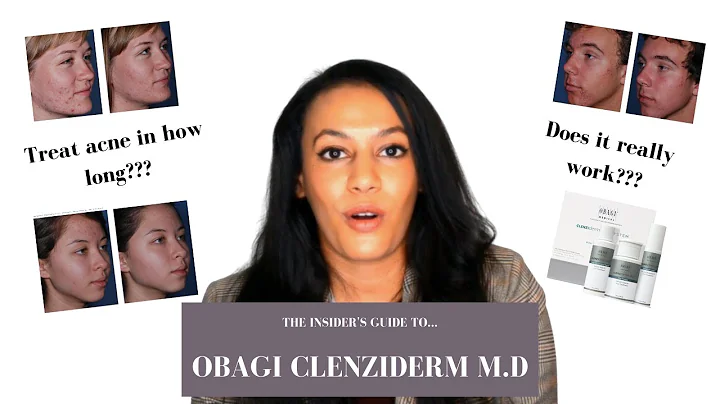 Obagi CLENZIderm MD Acne System Review - How to use CLENZIderm