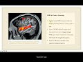 fMRI and PET - Educational Video in ENT by Dr. Shyam Kalyan N (World ENT Care)