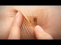 A temporary tattoo that brings hospital care to the home | Todd Coleman