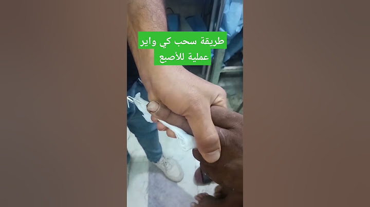طريقه سحب كي واير عملية جراحية في الأصبع المكسور