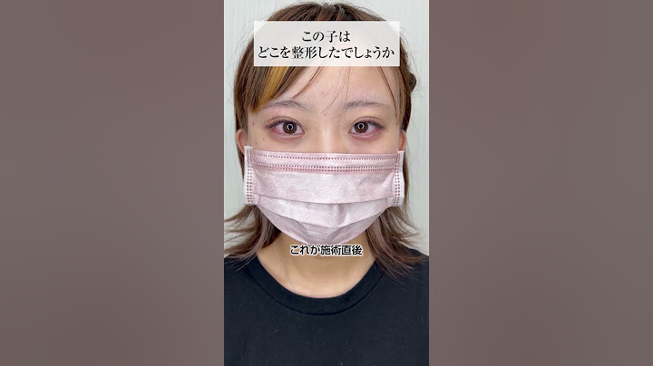 整形クイズ！整形した箇所を見抜ける？#shorts #あきよし先生