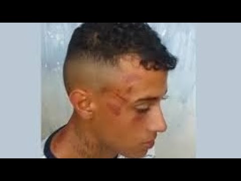 Ambulante de 20 anos agredido por seguranças do Shopping Grand Plaza ( análise da conduta dos Vig)