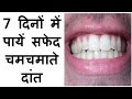 How To Whiten Teeth At Home Fast In Hindi