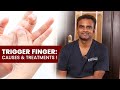 Trigger finger causes  treatments   dr sree charan