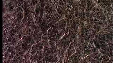 Stem Cells:  Heart cells grown from mouse stem cells