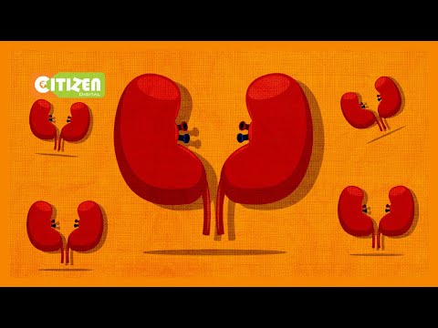 Gharama Ya Kusafisha Damu Kila Wiki Imewalemea Wanaogua Figo