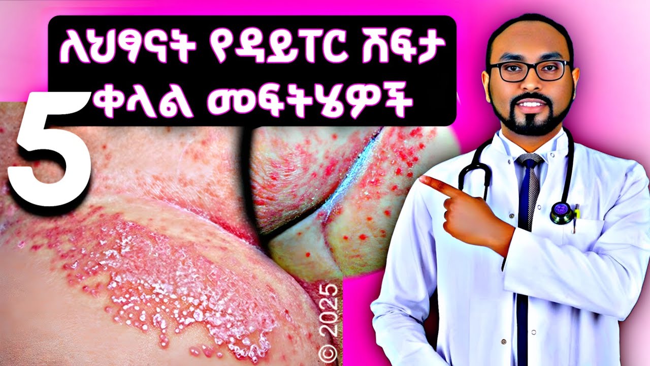 ለህፃናት የዳይፐር ሽፍታ 5 ቀላል መፍትሄዎች | 5 simple solutions for diaper rash in babies