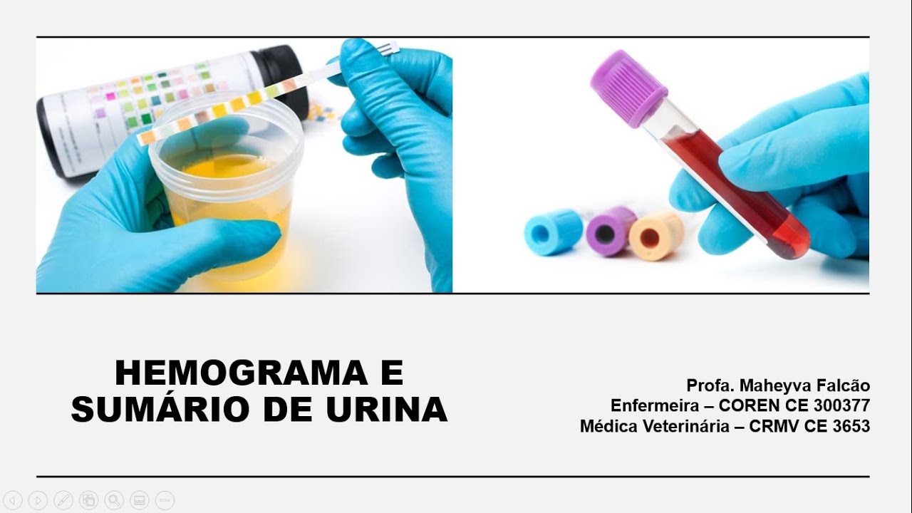 2ª Aula Preparação de Exames: Hemograma e Sumário de Urina - YouTube