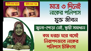 নাকের পলিপাস দূর করার উপায় । নাকের মাংস বৃদ্ধির চিকিৎসা | Alhera Homeo