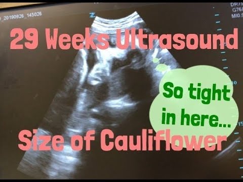 29 Weeks Ultrasound 妊娠29週のエコー