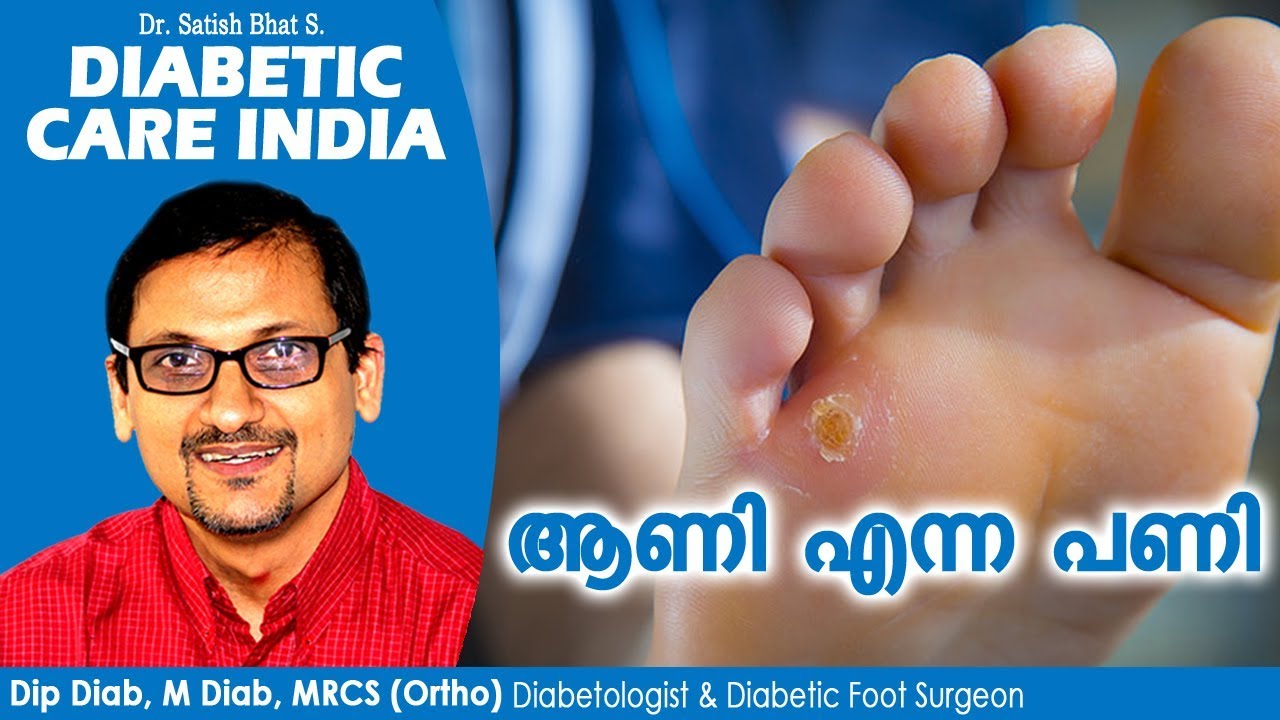 ആണി എന്ന പണി Diabetic Care India Malayalam Health Tips YouTube