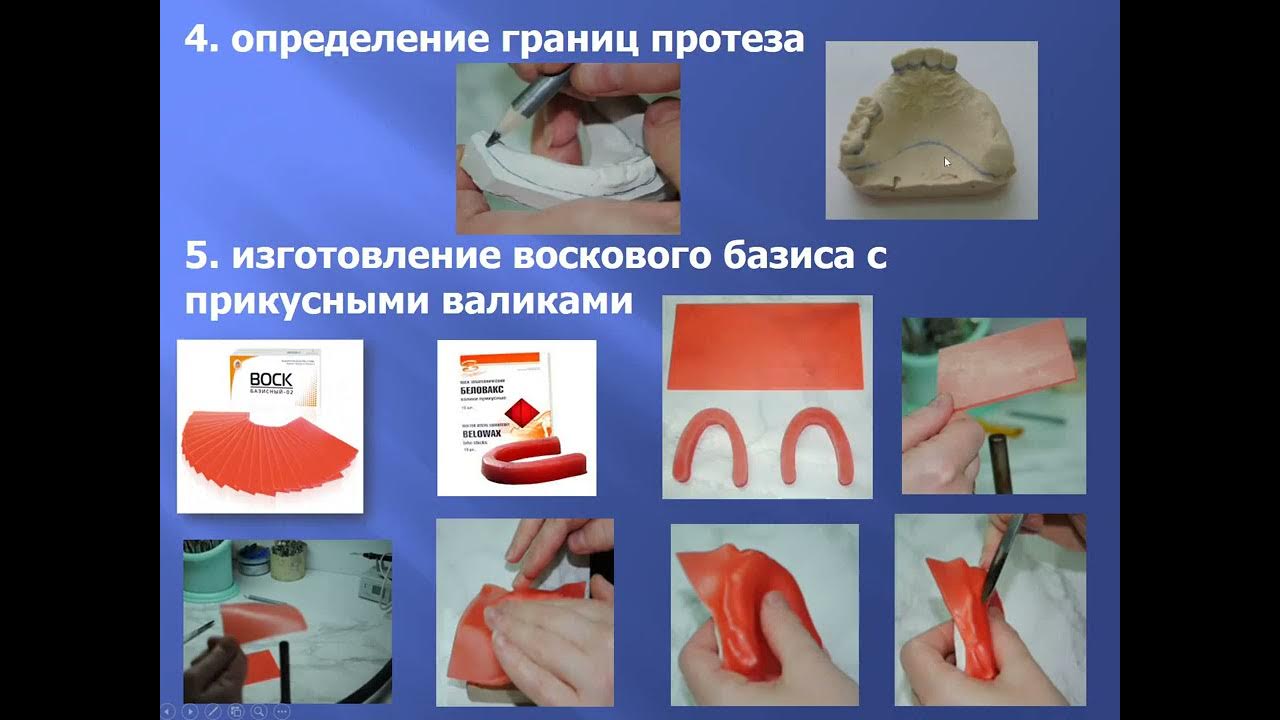 Изготовление базисов съемных протезов. Материалы для изготовления базисов протезов. материалы для изготовления съемных пластиночных протезов. этапы изготовления полного съемного протеза. этапы изготовления полного съемного пластиночного протеза.