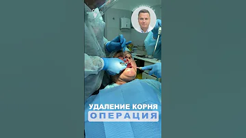 Удаление корня зуба. Не для слабонервных.