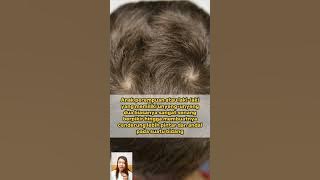 ARTI UNYENG-UNYENG DIKEPALA, ADA YANG BERARTI BAIK DAN BURUK #short #misteri #mitos #viral #trending