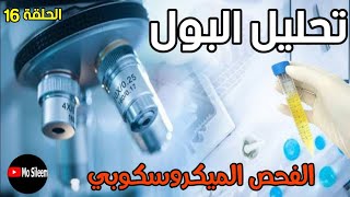 Urinalysis 16 (Microscopic examination) 🔬