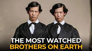 "Siamese Twins" the World Paid to Look At