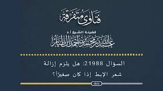 السؤال رقم 21988  ما حكم إزالة شعر الإبط؟ _أ.د عبدالله الطيار