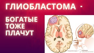 Глиобластома - богатые тоже плачут