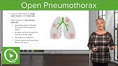 Tension Pneumothorax - Medical Animation - YouTube