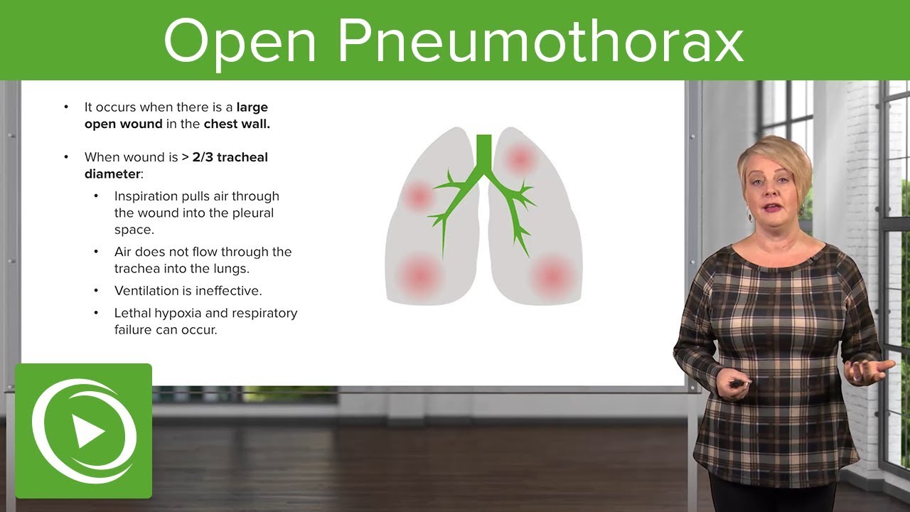 Open Pneumothorax & Flail Chest – Emergency Medicine | Lecturio