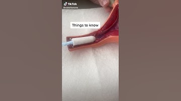 Thumbnail of 😕😕#period#periods_#periodpoverty_#poverty#tampon_#pad_#tampons #short