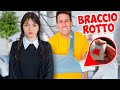 LUÌ È CADUTO E SI È ROTTO IL BRACCIO!! *MERCOLEDÌ È TORNATA*