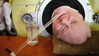 Paul Alexander dies after spending more than 70 years inside an iron lung