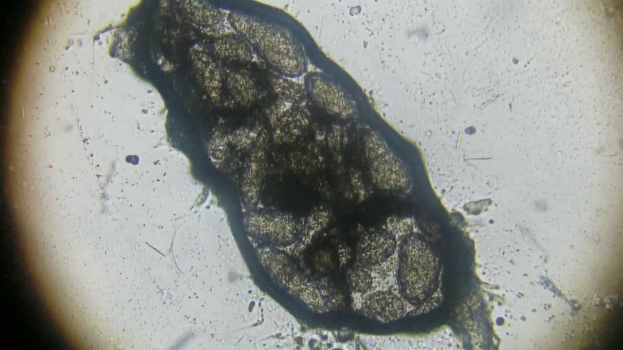 camera iphone 8 plus apk Microscope Footage UNCUT From Decades-old Canned Foods 5
