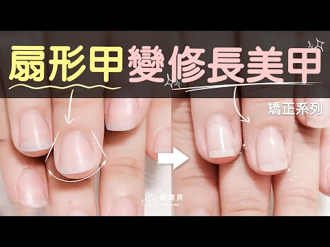 "寬扁扇形甲"變修長美甲,保濕不足重新矯正的例子❤️