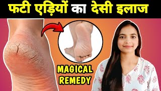 Cracked Heels Home Remedy | फटी एड़ियाँ ठीक करने का सबसे असरदार तरीका