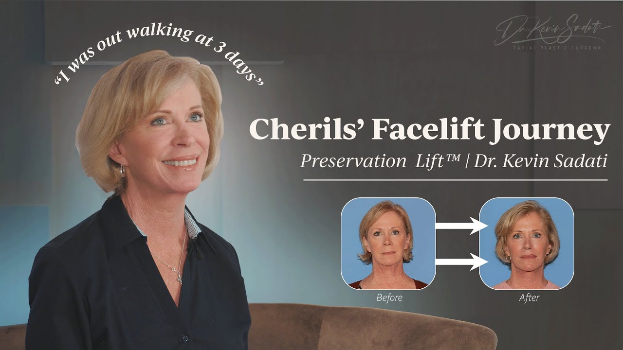 Cheril's Preservation Facelift Recovery with Elixir MD