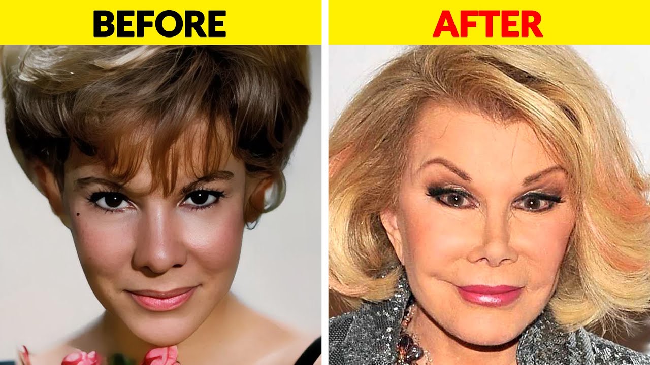 Знаменитости, чьи пластические операции прошли ужасно неудачно.