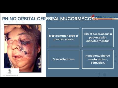 Mucormycosis Prevention & Care_Part 2