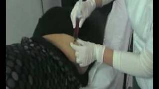 OZONOMEDICA TRATAMIENTO PARA EL ASMA OZONOMEDICA TRATAMIENTO PARA EL ASMA