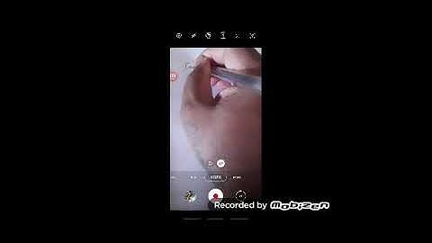 Binomial Distribution Part 01 by Sunil Kumar M N