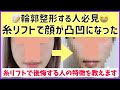 【美容整形】糸リフトをしたら顔が大変なことになりました。ダウンタイム・費用・やって後悔する人の特徴を教えます。