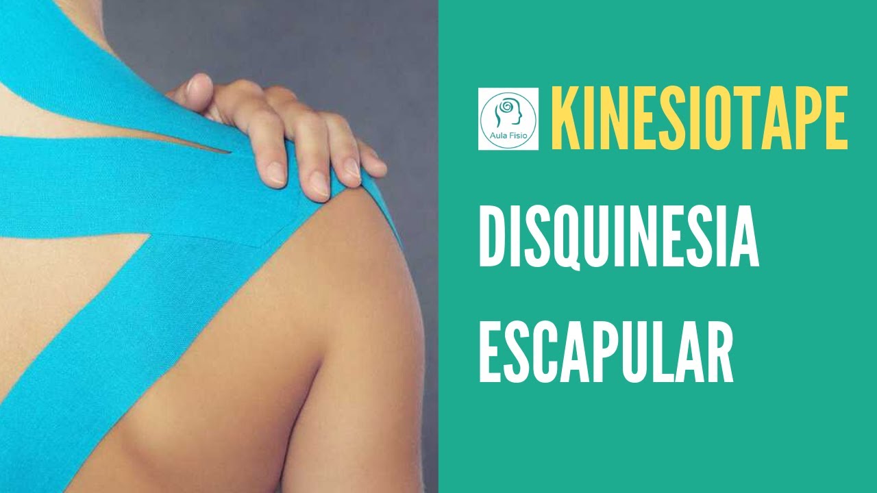KINESIOTAPE (Vendaje Neuromuscular) DISQUINESIA ESCAPULAR