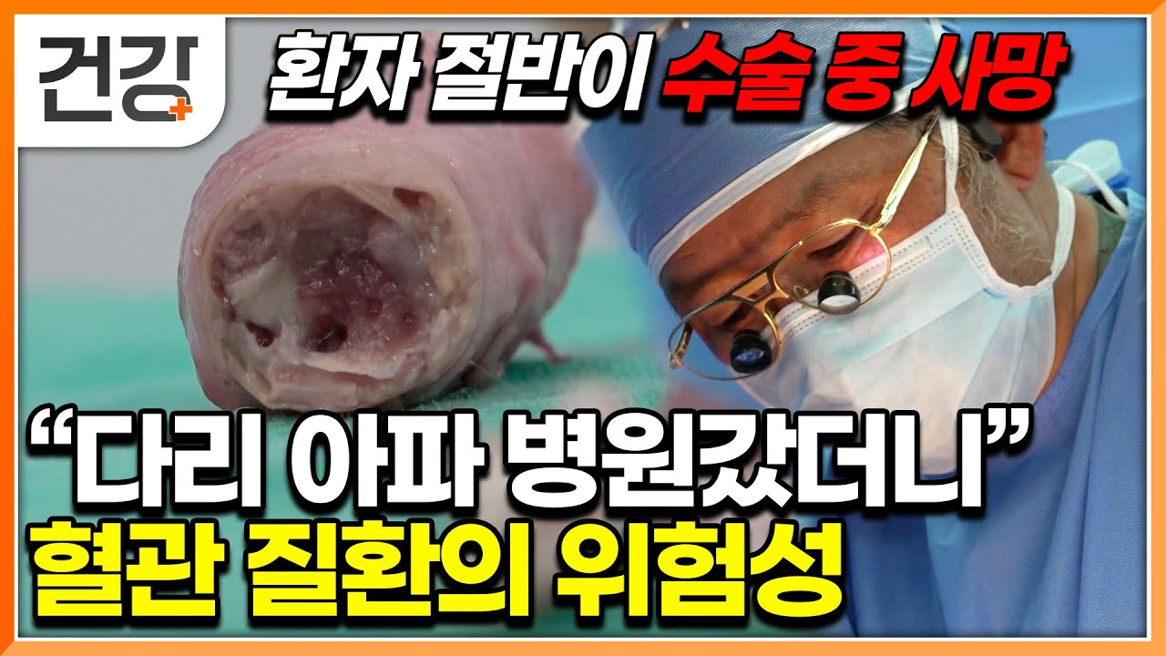 "건강하다가 갑자기 찾아온 죽음의 그림자" 증상 없어서 더 두려운 복부 대동맥 질환｜명의｜#EBS건강