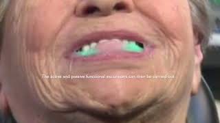 Mucopren Soft Relining Material. screenshot 3