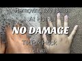 Watch Me Remove My Nails at Home | TikTok Nail Hack