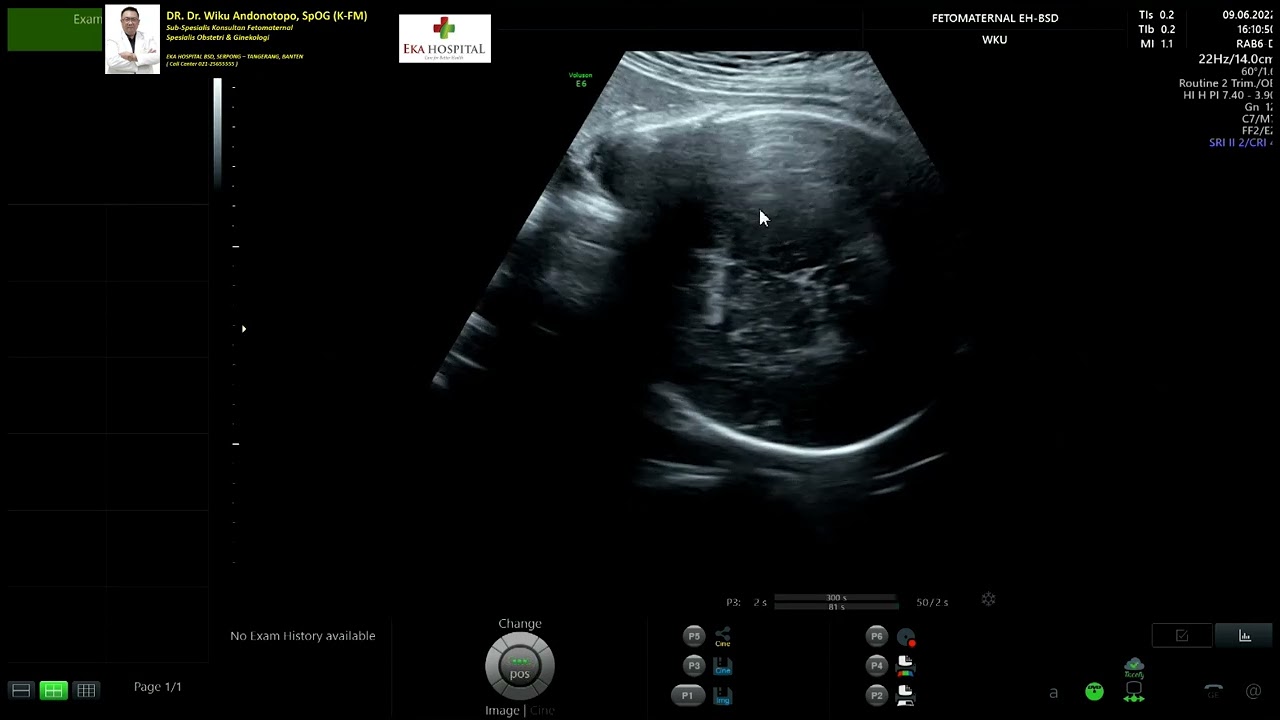 DOPPLER ARTERIAL SAMPLING (Dr Wiku Andonotopo)